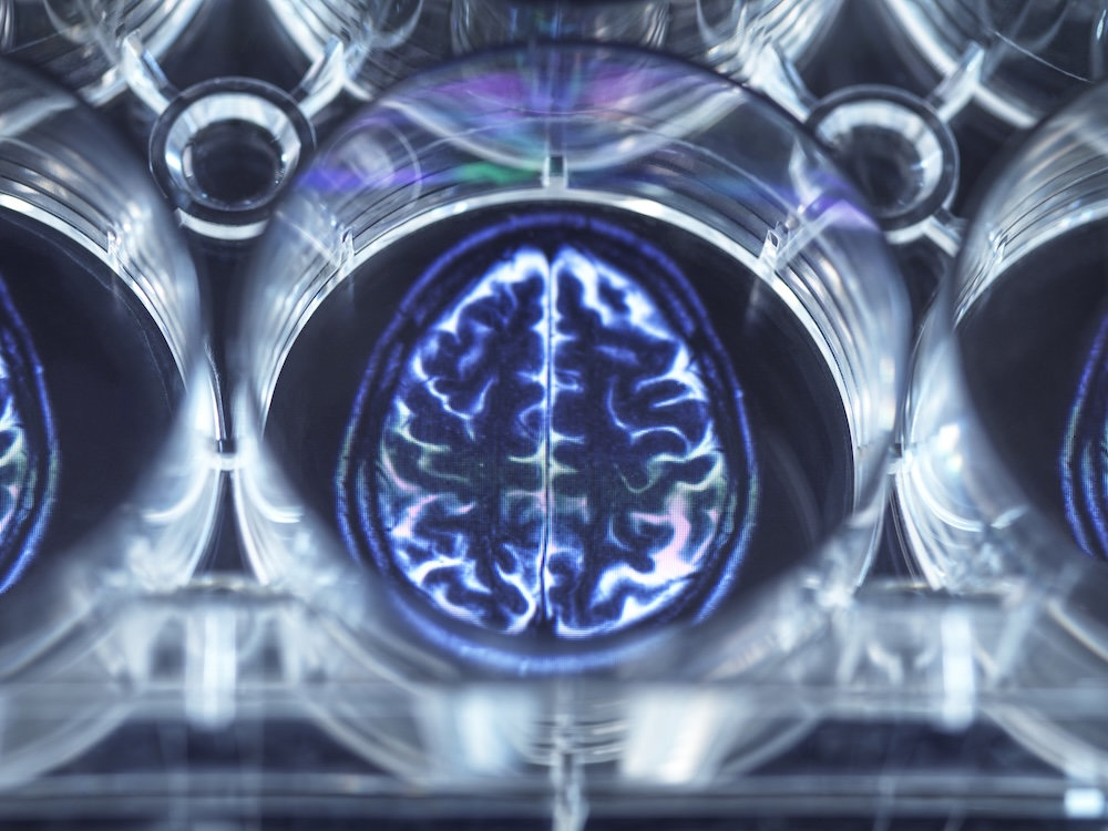 Futuristic brain visualization with consciousness streams